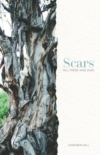 Scars: His, Theirs and Ours